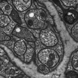 STEM mouse brain tissue GeminiSEM