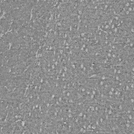 multi beam mouse brain MultiSEM 2