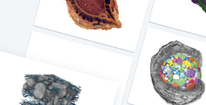 Webinar ZEISS Röntgenmikroskopie und Fortschritte